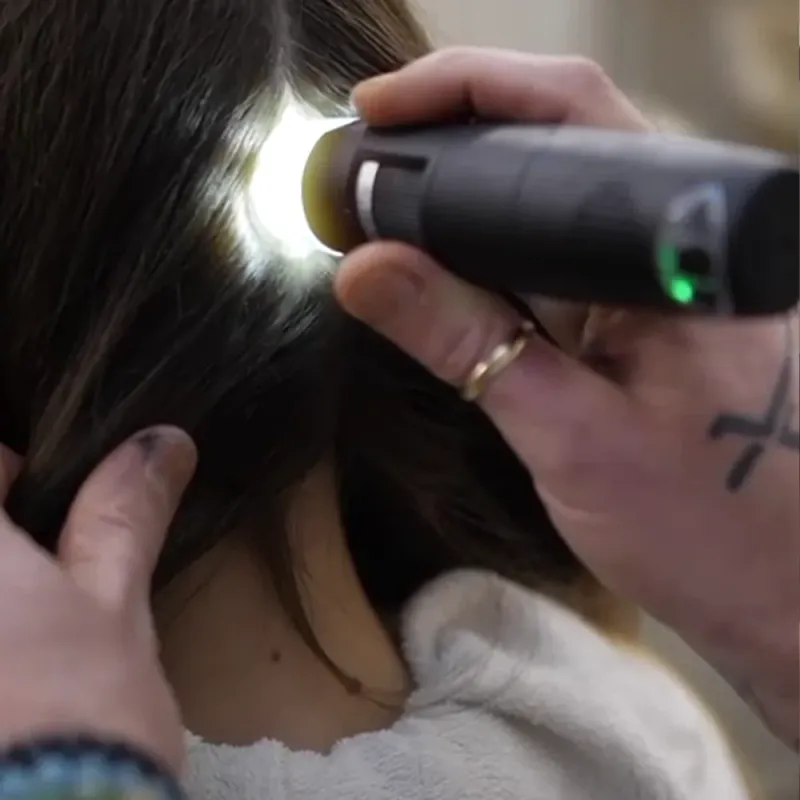 Initiation à la caméra capillaire